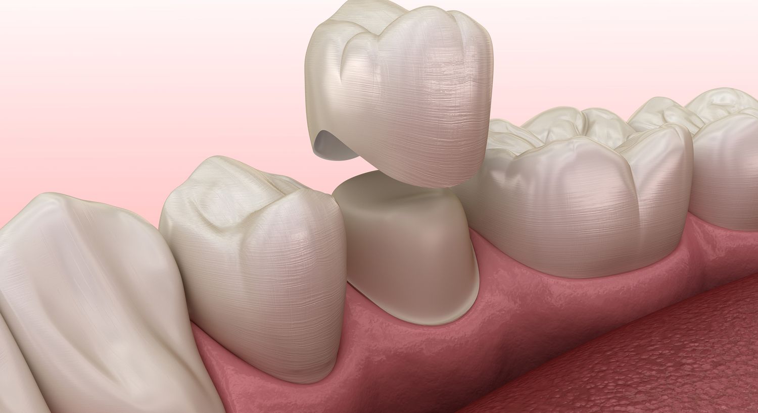 Smiling older woman with short gray hair.